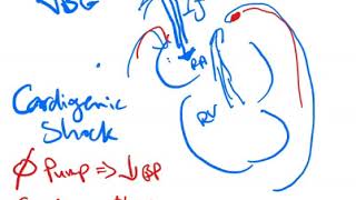 Central Venous Oxygen Saturation  Dr Jamal USMLE [upl. by Elyk]