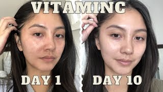 adding VITAMIN C serum to my skincare routine for 10 days  Vichy LiftActiv before amp after [upl. by Aitnic217]