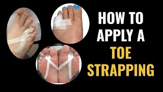 How Do I Do Toe Strapping Dislocated and Fractured Toe [upl. by Ahsienak]