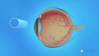 Peripheral Vision and Central Vision in the Retina [upl. by Ettenan]