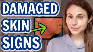 How to tell when your SKIN BARRIER IS DAMAGED Dr Dray [upl. by Eden]