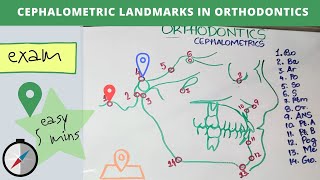 cephalometric landmarks in orthodontics [upl. by Eduino]