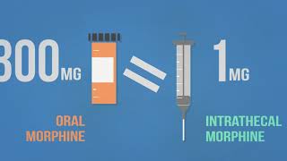 Intrathecal Baclofen Therapy for Spasticity [upl. by Reisfield]