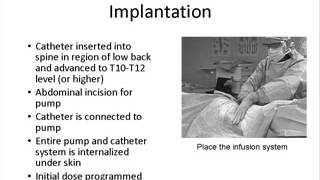 Interventional Radiology Series Part 1 Intro to the Service [upl. by Notsag]