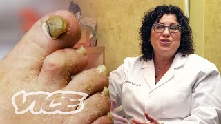 Meet a Toenail Fungus Expert [upl. by Charron]