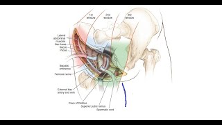 Ilioinguinal Approach According to the Letournel [upl. by Ahselrak]