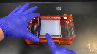 Agarose Gel Electrophoresis [upl. by Risa]