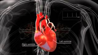 What is atrial fibrillation [upl. by Thormora]