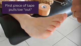 How To Hold A Curly Pinky Toe Straight With Tape [upl. by Shea]