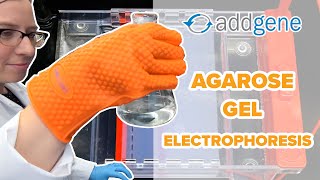 Agarose Gel Electrophoresis [upl. by Rednaskela]