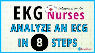 Learning to Read an ECG 8 simple steps [upl. by Okia]