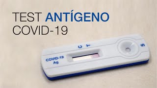 Test Antígeno COVID19 Clínica CEMTRO [upl. by Iahk]