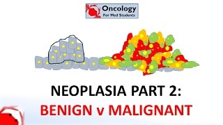 2 Neoplasia part 2 Differences between benign and malignant neoplasms [upl. by Ros]