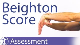 The Beighton Score  Generalized Joint Hypermobility Laxity [upl. by Iyre]