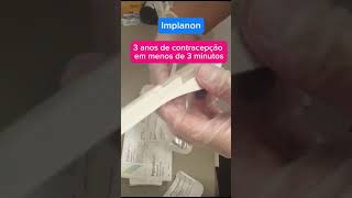 Implante contraceptivo [upl. by Namdor]