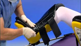 Allen Medical  Allen Stirrups  Instructional Video [upl. by Victoria]