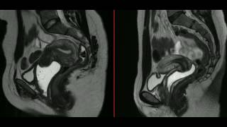 AULA Pelve  introdução e anatomia básica [upl. by Yennor]