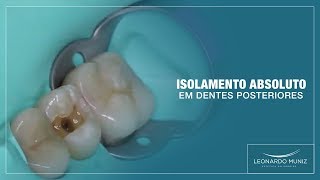 Isolamento Absoluto em Dentes Posteriores  Leonardo Muniz [upl. by Ainslee]