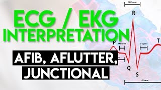 Afib Aflutter Junctional Arrhythmias  ECG EKG Interpretation Part 4 [upl. by Esorylime768]