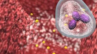 Bacterial infection and host response [upl. by Malinowski]