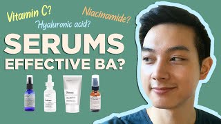 BEST SERUMS NIACINAMIDE VIT C HYALURONIC ACID  Effective ba My Personal Experience  Jan Angelo [upl. by Esidnak]